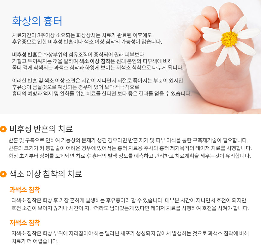 화상의 흉터치료